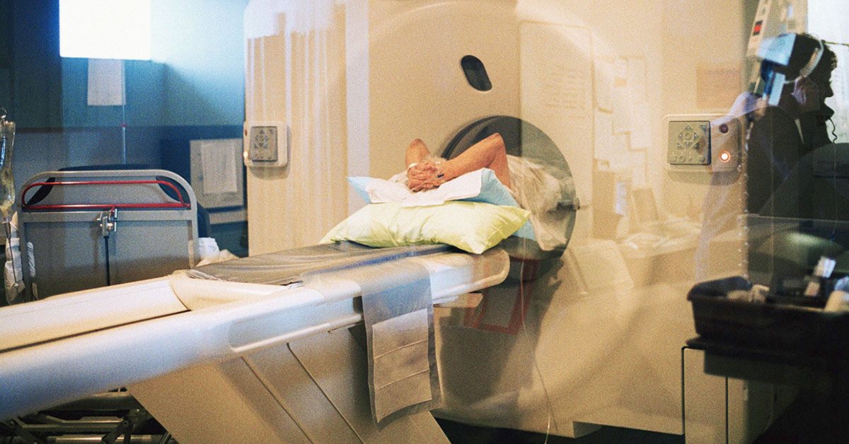 CT scans of visceral fat may help predict risk