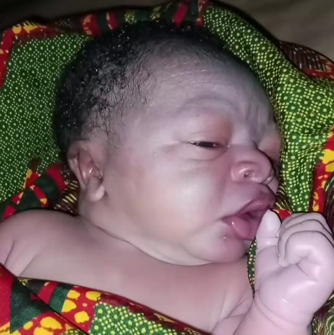 Newborn baby sparks social media reactions with unique facial appearance