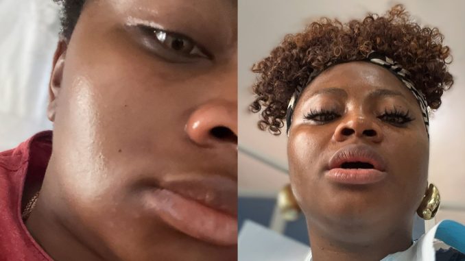 "My 1-Month Toothache Miraculously Disappeared During a Prayer Session" – BBNaija Tega Dominic confirms healing (IMAGES)