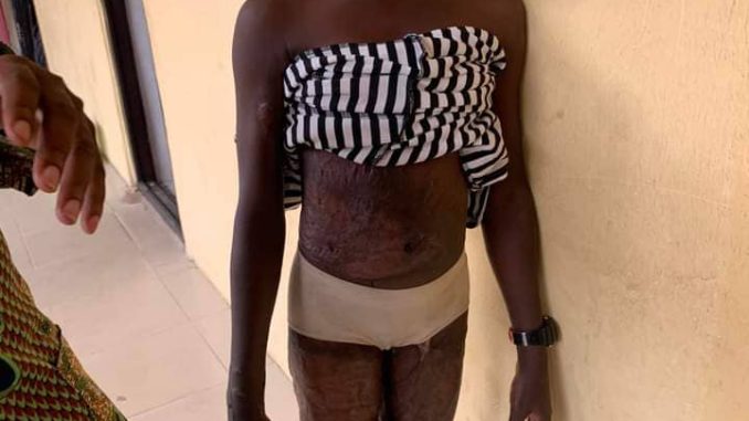 Imo teacher in police net over maltreatment of 12-year-old step-daughter