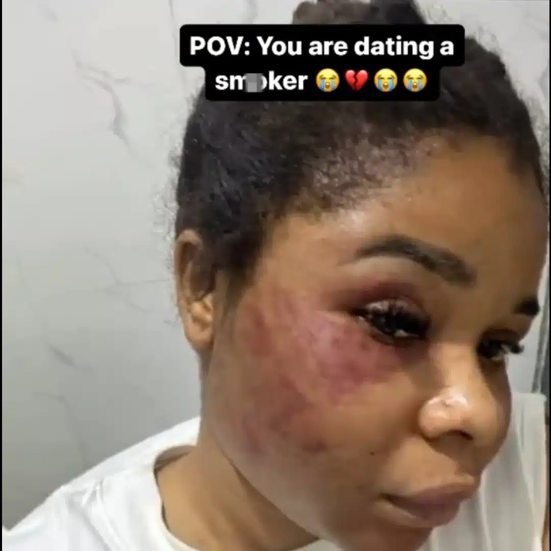 Lady dating a smoker shocks social media with disturbing body reveal