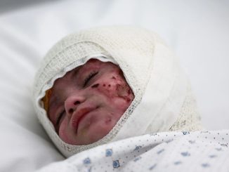 Heartbreaking image shows baby wrapped in bandages after suffering horror burns in Israeli airstrike on Lebanon hometown