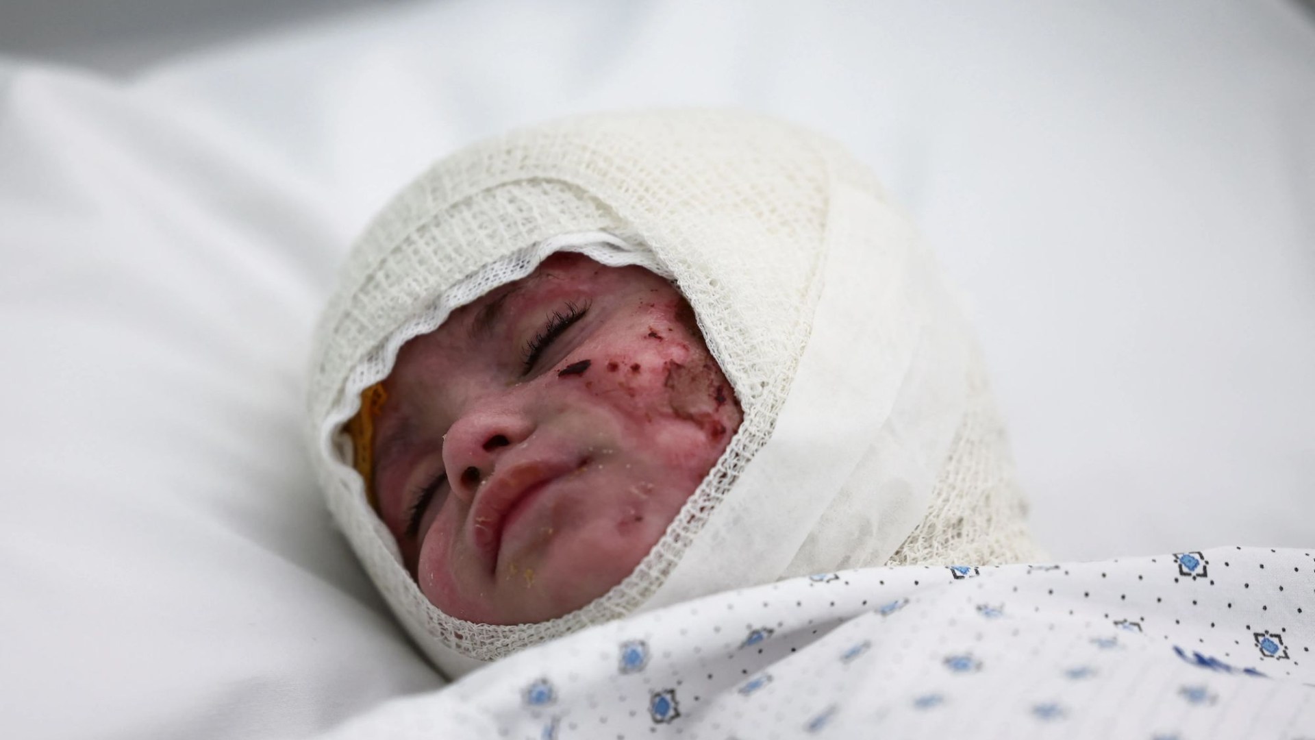 Heartbreaking image shows baby wrapped in bandages after suffering horror burns in Israeli airstrike on Lebanon hometown