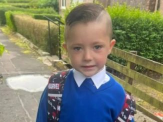 Five-year-old boy mauled by XL Bully as horror attack leaves him needing facial reconstruction