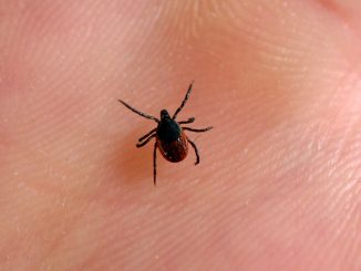 Woman, 28, loses her hair after being bitten by a common bug that's on the rise in the UK