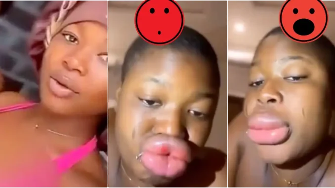 Lady cries out over sudden lips transformation after a fun day