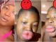 Lady cries out over sudden lips transformation after a fun day