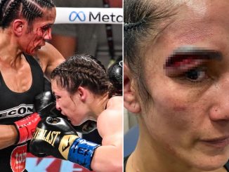 Amanda Serrano shows of gruesome gaping wound above her eye after controversial defeat to Katie Taylor