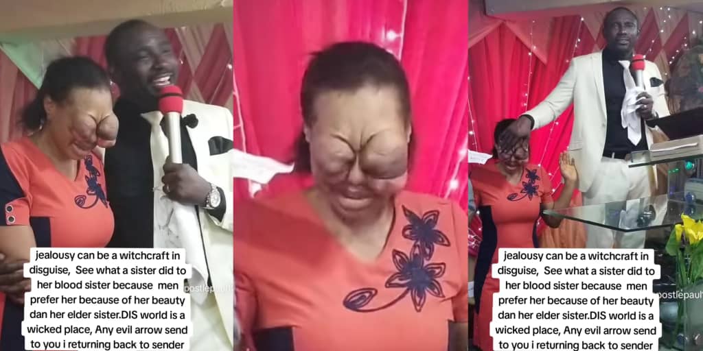 Lady allegedly damages sister's eye out of jealousy over beauty preference from men