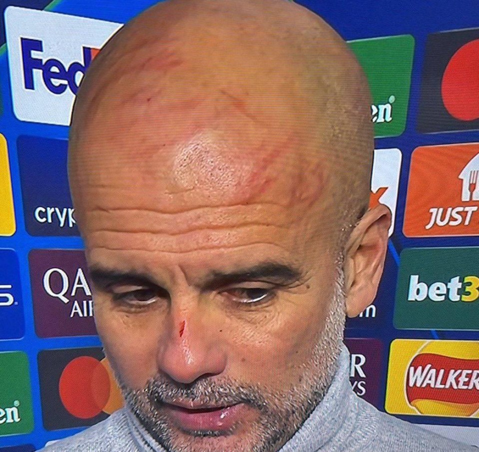 Guardiola's head looked to have suffered more than most during the second-half collapse