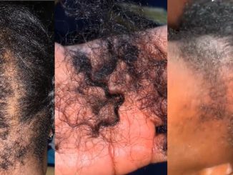 "My back hair is gone" – Lady l0ses hair after relaxing and braiding on the same day (WATCH)