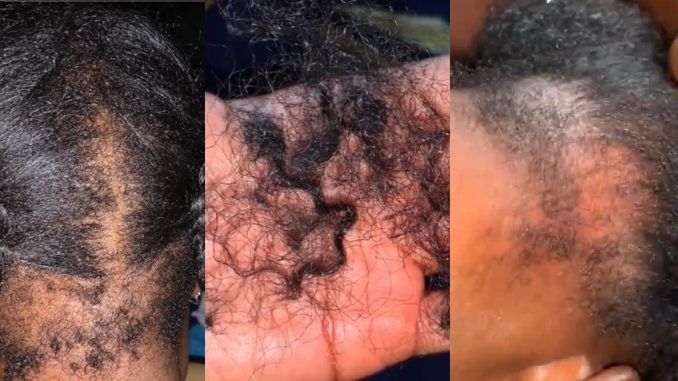 "My back hair is gone" – Lady l0ses hair after relaxing and braiding on the same day (WATCH)