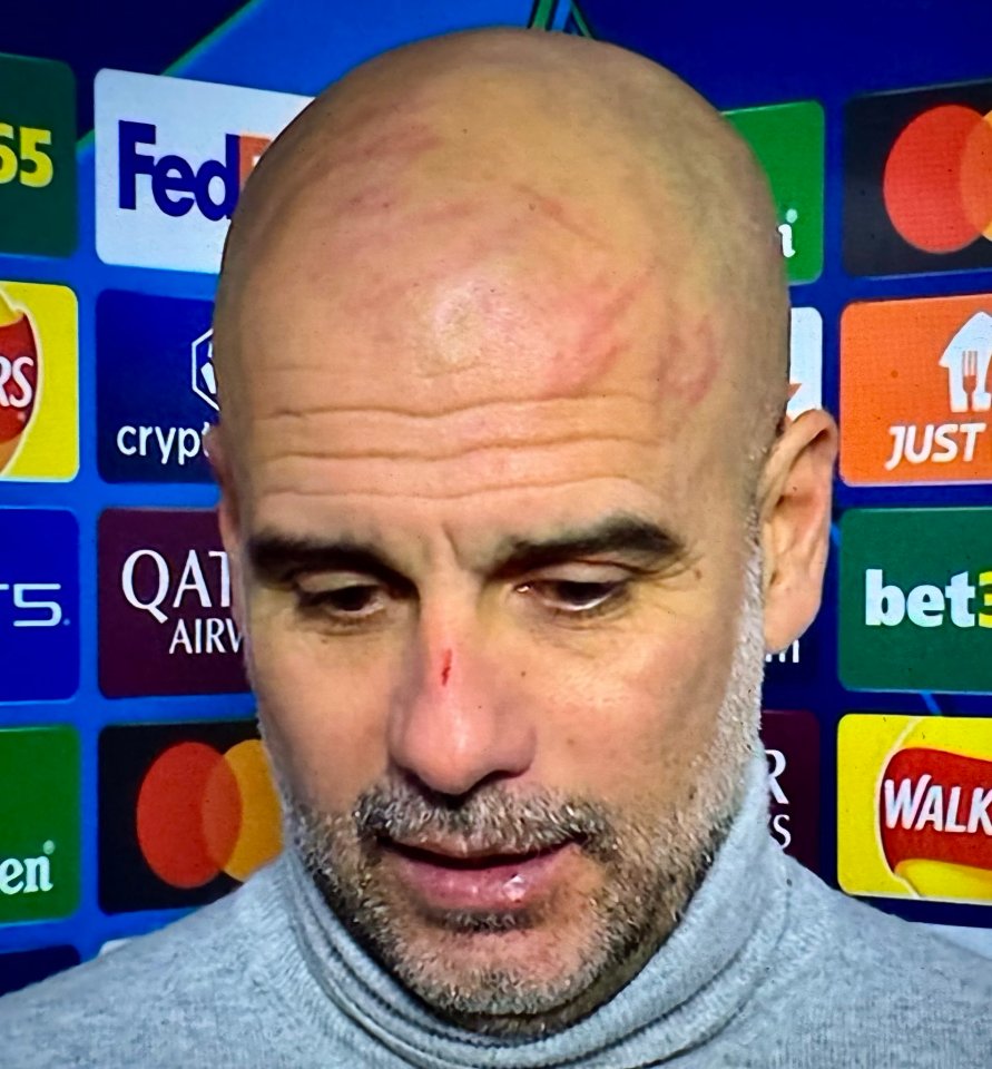 Pep Guardiola has been left scratching his head at recent performances