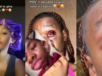 Lady shocks internet with video of severe injuries after giving love a chance