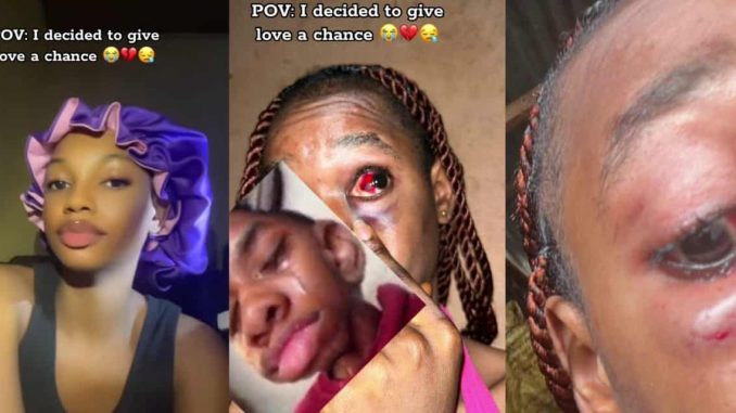 Lady shocks internet with video of severe injuries after giving love a chance