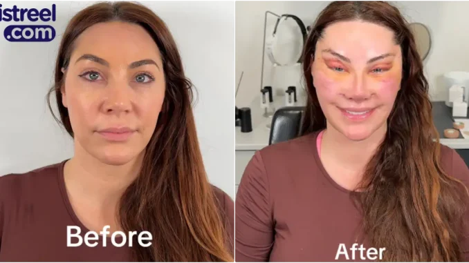 Lady's facial transformation after six surgeries sparks mixed reactions