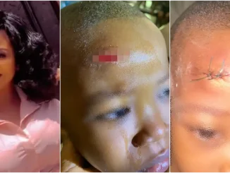 Mother cries out over scar on son inflicted by classmate at school