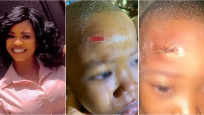 Mother cries out over scar on son inflicted by classmate at school