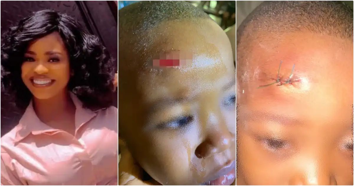 Mother cries out over scar on son inflicted by classmate at school