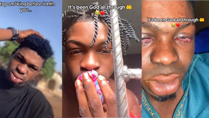 “Stop sm0king before it kpai you” – Man w@rns as he shares 'eye-catching' result of what sm0king did to him (VIDEO)