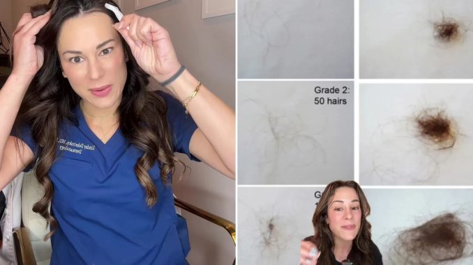 This is what normal autumnal hair loss looks like… you can grow back lost strands quick with £5 buy, says dermatologist