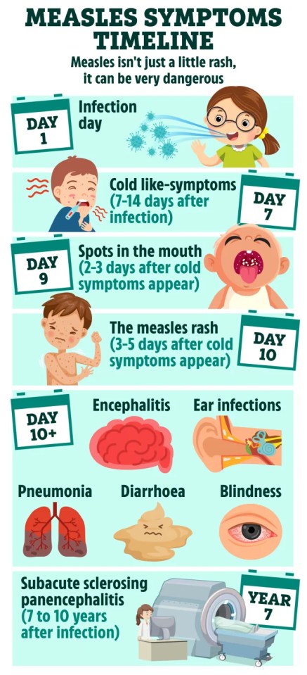 The illness begins with cold-like symptoms before progressing to the telltale rash