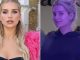 Lottie Moss shows off new face after having filler dissolved and correctional procedures after botched treatment