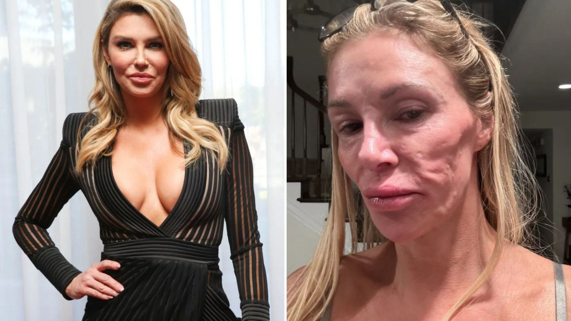 Brandi Glanville looks unrecognizable with swollen face as she's supported by fans over shock health condition