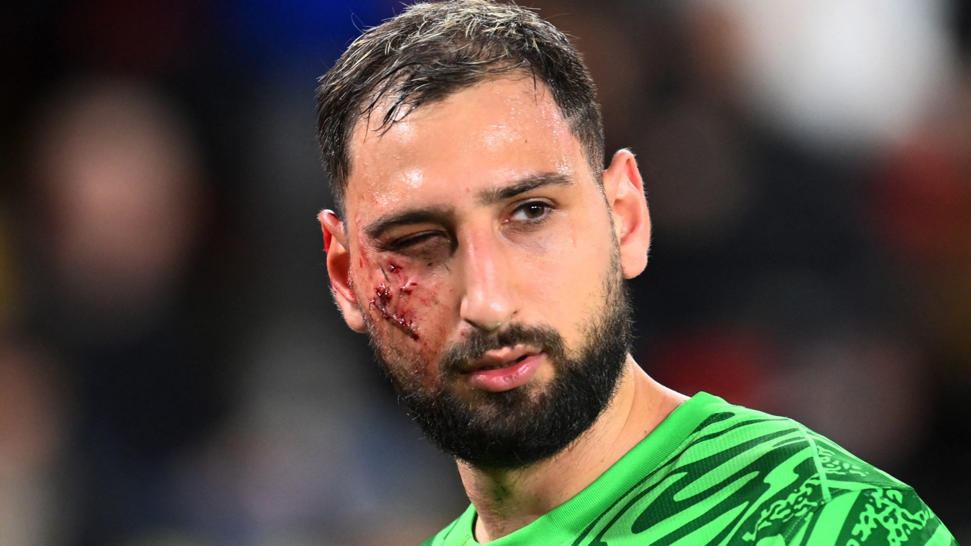 Gianluigi Donnarumma update as full extent of PSG star's gruesome injuries revealed after horror challenge