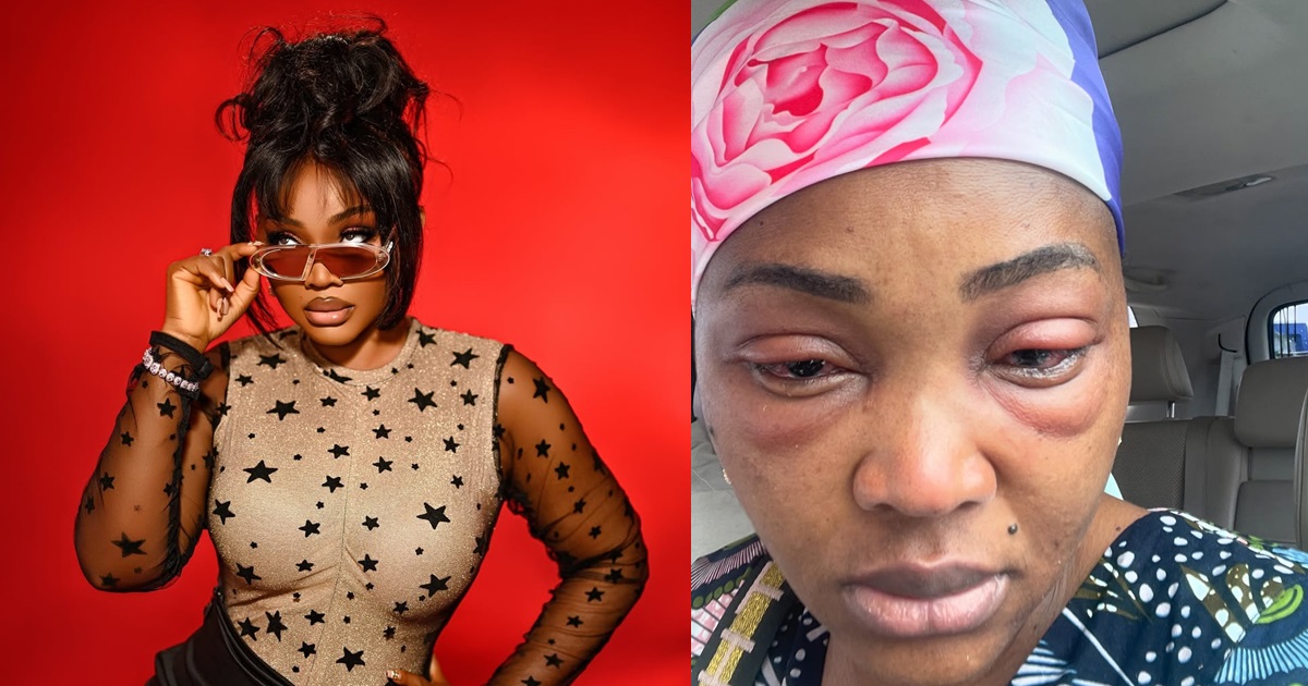 Actress Mercy Aigbe recounts how she battlɘd eye infect!on while filming her new movie (IMAGES)