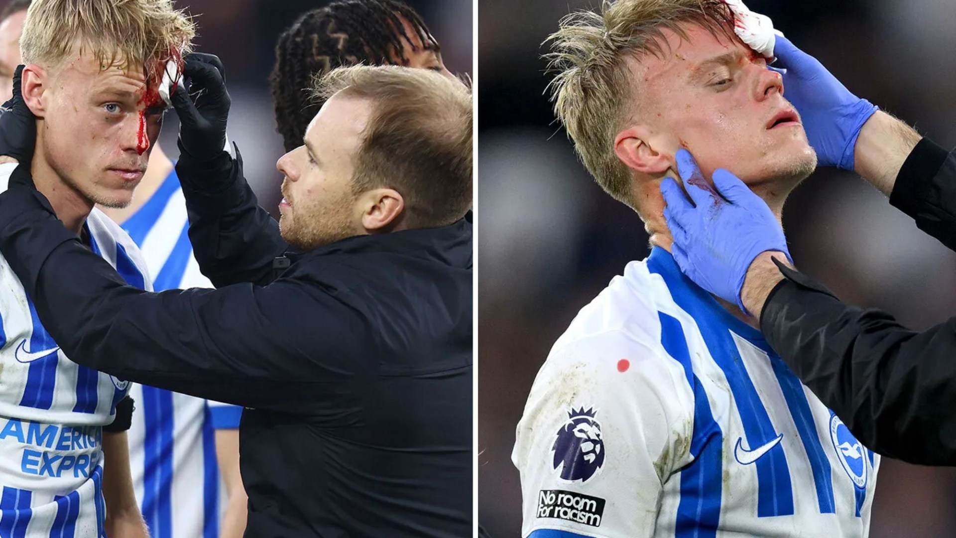 Brighton star Jan Paul van Hecke left with blood pouring down his face after being injured by own team-mate